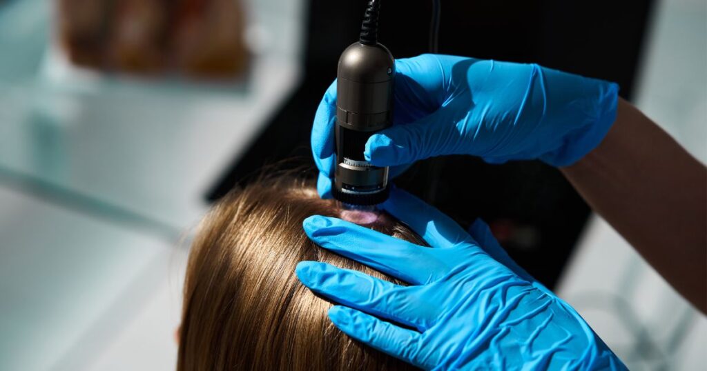 Dermatologista avaliando couro cabeludo com tricoscopia