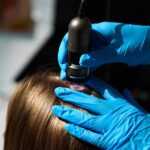 Dermatologista avaliando couro cabeludo com tricoscopia