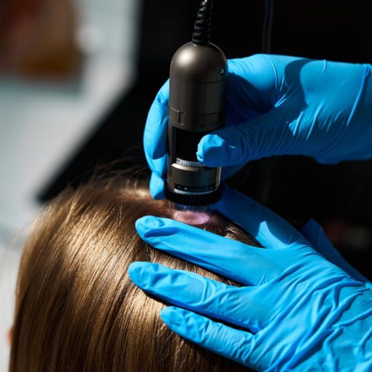 Dermatologista avaliando couro cabeludo com tricoscopia